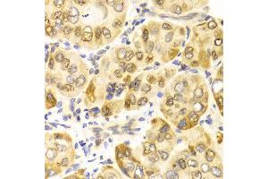 Immunohistochemistry (IHC) image for anti-Carnitine Palmitoyltransferase 2 (CPT2) antibody (ABIN3023425) (CPT2 Antikörper)