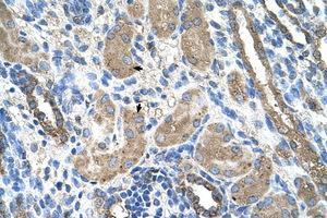 anti-Cytochrome P450, Family 2, Subfamily D, Polypeptide 6 (CYP2D6) (AA 101-150) antibody