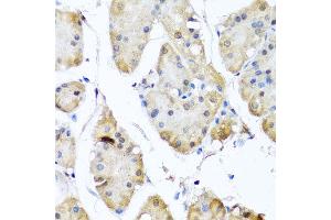 Immunohistochemistry of paraffin-embedded human gastric using YAP1 antibody at dilution of 1:100 (x40 lens). (YAP1 Antikörper)
