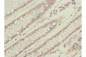 Immunohistochemistry (IHC) image for anti-Wingless-Type MMTV Integration Site Family, Member 9A (WNT9A) (AA 206-365) antibody (ABIN7166319)