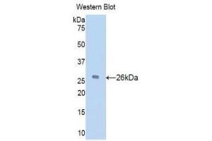 Western Blotting (WB) image for anti-Vitamin D-Binding Protein (GC) (AA 205-403) antibody (ABIN1078667) (Vitamin D-Binding Protein Antikörper  (AA 205-403))