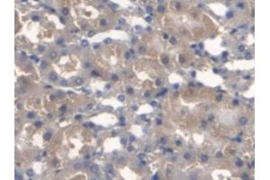 Detection of TMEM27 in Mouse Kidney Tissue using Monoclonal Antibody to Transmembrane Protein 27 (TMEM27) (TMEM27 Antikörper  (AA 12-222))