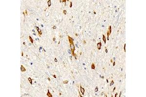 Immunohistochemistry of paraffin embedded mouse spinal cord using NACAD (ABIN7074756) at dilution of 1:1000 (400x lens)
