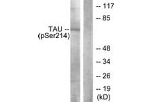 Western blot analysis of extracts from HeLa cells, using Tau (Phospho-Ser214) Antibody. (tau Antikörper  (pSer531))
