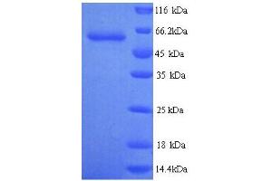 SDS-PAGE (SDS) image for Glypican 6 (GPC6) (AA 24-529) protein (His tag) (ABIN5713478) (Glypican 6 Protein (GPC6) (AA 24-529) (His tag))