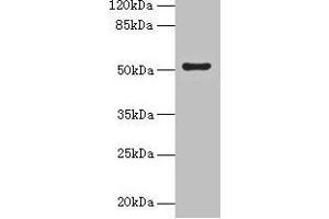 Western blot All lanes: SLC46A3 antibody at 4 μg/mL + Jurkat whole cell lysate Secondary Goat polyclonal to rabbit IgG at 1/10000 dilution Predicted band size: 52, 43 kDa Observed band size: 52 kDa (SLC46A3 Antikörper  (AA 26-73))