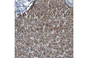 Immunohistochemical staining of human liver with SVOPL polyclonal antibody  shows moderate cytoplasmic positivity in hepatocytes at 1:50-1:200 dilution. (SVOPL Antikörper)