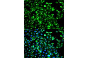 Immunofluorescence analysis of A549 cells using CAPN5 antibody (ABIN5975527). (Calpain 5 Antikörper)