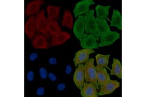 ABIN6262117 and ABIN6278010 staining Hela cells(30 min of UV treatment) by IF/ICC. (GSTK1 Antikörper  (C-Term))