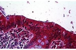 Human Colon, Epithelium: Formalin-Fixed, Paraffin-Embedded (FFPE) (LRP4 Antikörper  (AA 1765-1777))