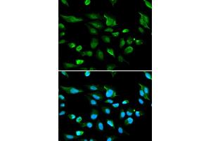Immunofluorescence analysis of A549 cell using AIRE antibody. (AIRE Antikörper)
