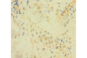 Immunohistochemistry of paraffin-embedded human placenta tissue using ABIN7144701 at dilution of 1:100 (Arylsulfatase I Antikörper  (AA 301-569))