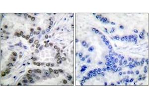 Immunohistochemistry (IHC) image for anti-CREB Binding Protein (CREBBP) (acLys1535) antibody (ABIN2890736) (CBP Antikörper  (acLys1535))