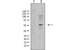 Western blot analysis of extracts from Hela, using RAD51L2 Antibody. (RAD51C Antikörper  (Internal Region))