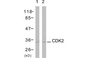 Western blot analysis using CDK2 (epitope around residue 161) Antibody (ABIN5976214) Line1: The extracts from A2780 cells (CDK1 Antikörper  (Thr161))