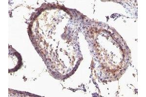 Formalin-fixed, paraffin-embedded human testicular carcinoma stained with anti-TGF alpha antibody (SPM542) (TGFA Antikörper  (AA 34-43))