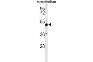 Western blot analysis of ANKH Antibody (C-term) in mouse cerebellum tissue lysates (35ug/lane). (ANKH Antikörper  (C-Term))