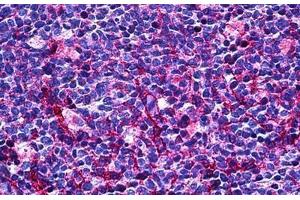 Human Tonsil: Formalin-Fixed, Paraffin-Embedded (FFPE) (CD31 Antikörper  (AA 686-735))