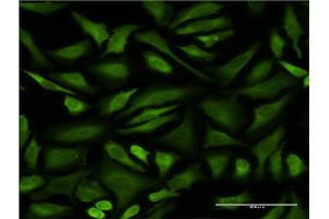 Immunofluorescence of monoclonal antibody to STIP1 on HeLa cell.