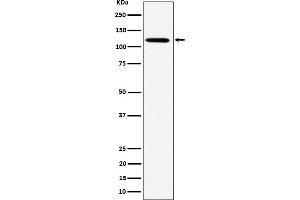 Western blot analysis of KIF5B expression in HeLa cell lysate. (Rekombinanter KIF5B Antikörper)