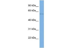 Host:  Rabbit  Target Name:  SLC22A14  Sample Type:  Jurkat Whole cell lysates  Antibody Dilution:  1.