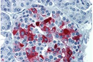 Human Pancreas: Formalin-Fixed, Paraffin-Embedded (FFPE) (RBP4 Antikörper  (AA 19-202))