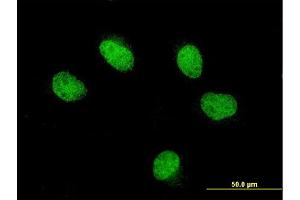 Immunofluorescence of monoclonal antibody to FOXQ1 on HeLa cell. (FOXQ1 Antikörper  (AA 110-219))
