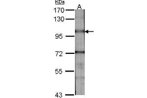 Western Blotting (WB) image for anti-Bone Morphogenetic Protein Receptor, Type II (serine/threonine Kinase) (BMPR2) (C-Term) antibody (ABIN2855391)