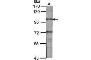 WB Image Sample (30 ug of whole cell lysate) A:NIH-3T3 7. (BMPR2 Antikörper  (C-Term))