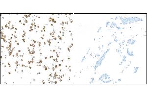Immunocytochemistry (ICC) image for anti-Ubiquitin Carboxyl-terminal Esterase L1 (Ubiquitin Thiolesterase) (UCHL1) (AA 50-100) antibody (ABIN7449527) (Rekombinanter UCHL1 Antikörper  (AA 50-100))