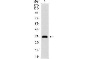 Western blot analysis using GSC mAb against human GSC recombinant protein. (GSC Antikörper  (AA 191-257))