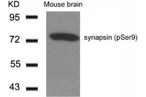 Western blot analysis of extracts from Mouse Brain tissue using synapsin(Phospho-Ser9) Antibody. (SYN1 Antikörper  (pSer9))