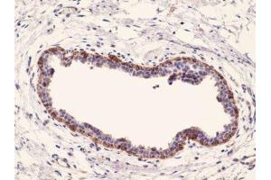 Immunohistochemistry (IHC) image for anti-Keratin 17 (KRT17) (C-Term) antibody (ABIN870567) (KRT17 Antikörper  (C-Term))