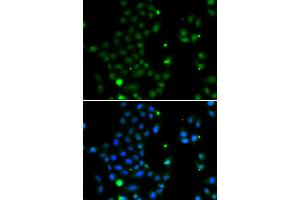 Immunofluorescence analysis of MCF-7 cells using GCM1 antibody (ABIN5974384). (GCM1 Antikörper)