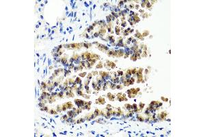 Immunohistochemistry of paraffin-embedded mouse lung using SIRT1 antibody (ABIN5970059) at dilution of 1/100 (40x lens). (SIRT1 Antikörper  (C-Term))