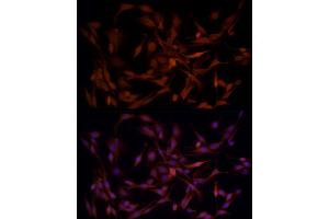 Immunofluorescence analysis of PC-12 cells using B1 Rabbit pAb (ABIN3022390, ABIN3022391, ABIN3022392, ABIN1512555 and ABIN6218779) at dilution of 1:50 (40x lens). (AKR1B1 Antikörper  (AA 1-316))