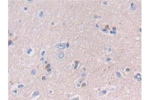 Detection of NCAM2 in Human Cerebrum Tissue using Polyclonal Antibody to Neural Cell Adhesion Molecule 2 (NCAM2) (NCAM2 Antikörper  (AA 21-297))
