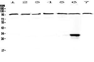 Western blot analysis of DGCR8 using anti-DGCR8 antibody . (DGCR8 Antikörper  (AA 561-762))