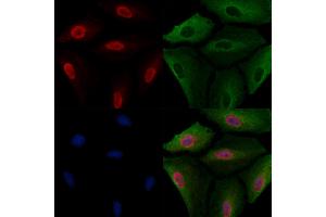ABIN6264373 and ABIN6277684 staining  cells by IF/ICC. (PPARD Antikörper  (C-Term))