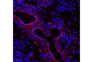 Immunofluorescence of paraffin embedded rat ovary using NRG2 (ABIN7074804) at dilution of 1: 500 (400x lens) (Neuregulin 2 Antikörper)