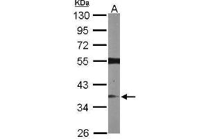 WB Image Sample (50 ug of whole cell lysate) A: Mouse brain 10% SDS PAGE antibody diluted at 1:1000 (RASSF2 Antikörper  (Center))