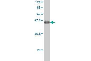 Western Blotting (WB) image for anti-Protein Kinase D2 (PKD2) (AA 1-110) antibody (ABIN565195)