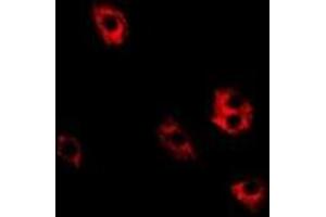 Immunofluorescent analysis of SRP19 staining in Hela cells. (SRP19 Antikörper)