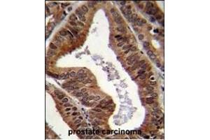 Immunohistochemistry (Paraffin-embedded Sections) (IHC (p)) image for anti-tyrosyl-DNA phosphodiesterase 2 (TDP2) (AA 246-272), (C-Term) antibody (ABIN655180)