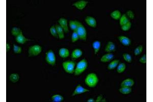 Immunofluorescent analysis of A549 cells using ABIN7144679 at dilution of 1:100 and Alexa Fluor 488-congugated AffiniPure Goat Anti-Rabbit IgG(H+L) (NAT2 Antikörper  (AA 1-290))