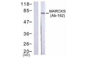 Image no. 1 for anti-Myristoylated Alanine-Rich Protein Kinase C Substrate (MARCKS) (Ser162) antibody (ABIN197518) (MARCKS Antikörper  (Ser162))