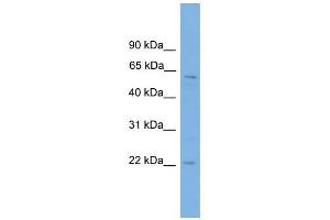FTO antibody used at 1 ug/ml to detect target protein. (FTO Antikörper  (Middle Region))