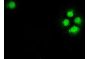 Anti-CHEK2 mouse monoclonal antibody (ABIN2452258) immunofluorescent staining of COS7 cells transiently transfected by pCMV6-ENTRY CHEK2 (RC201278). (CHEK2 Antikörper)
