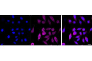 Immunocytochemical staining of HepG2 cells with P4HTM antibody (ABIN7799921), 1:1,000). (Rekombinanter P4HTM Antikörper)