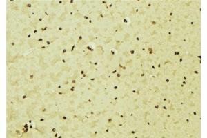 ABIN6276552 at 1/100 staining Mouse brain tissue by IHC-P. (IRF5 Antikörper  (C-Term))